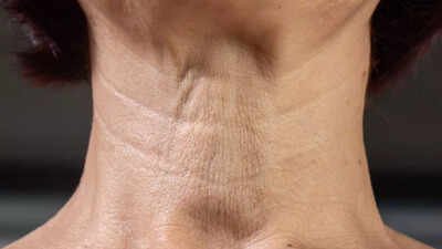 4 exercises to remove neck lines naturally and tighten sagging skin |