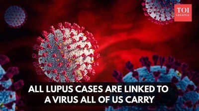 All lupus cases are linked to a virus all of us carry, study finds |