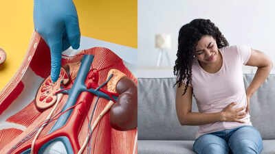 Kidney removal side effects: Understanding post-surgery pain, recovery, and health risks |