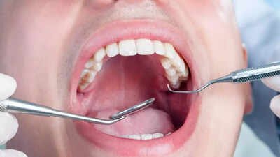 Root Canal Treatment: A popular dental treatment may reduce heart disease and diabetes risk — here’s what it is |