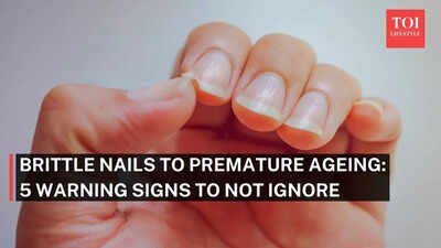 Brittle nails to premature ageing: 5 warning signs your body is struggling |