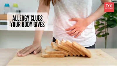 Signs you may have a food allergy and how doctors diagnose it |