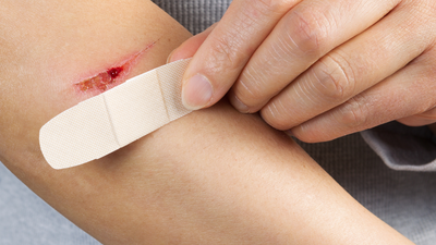 Girl shares why a small, unknown cut on public transport should not be ignored; shares personal experience of getting cut by blade